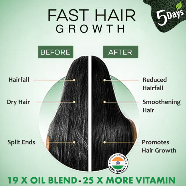 5 Days Fast Hair Growth Oil | 10 X Deeper Penetrationnnnnnnnnnnnnnnnn