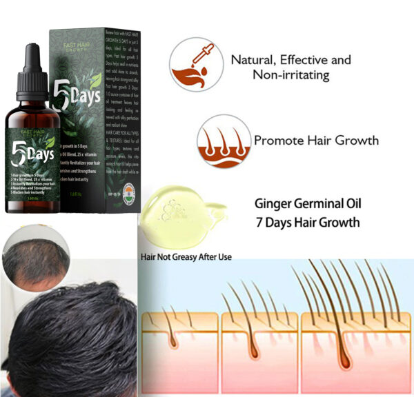 5 Days Fast Hair Growth Oil