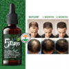 5 Days Fast Hair Growth Oil