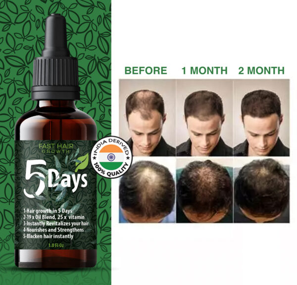 5 Days Fast Hair Growth Oil