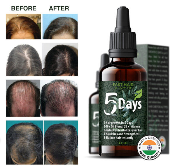 5 Days Fast Hair Growth Oil