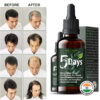 5 Days Fast Hair Growth Oil