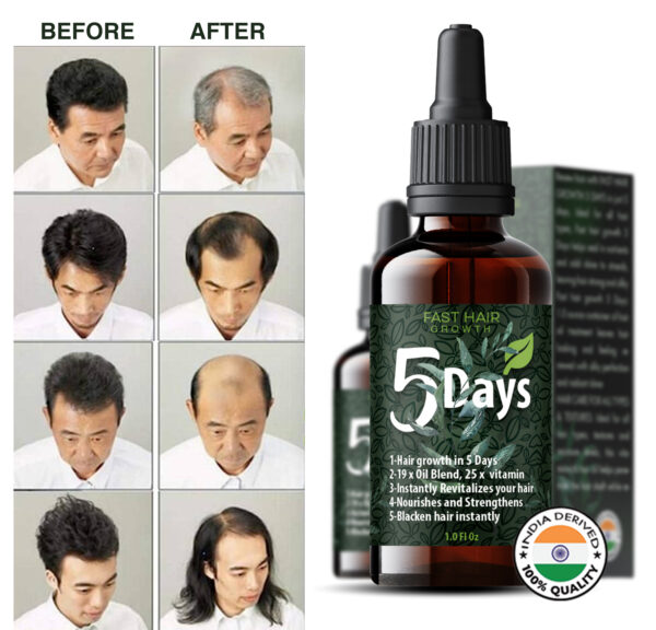 5 Days Fast Hair Growth Oil