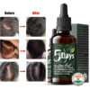 5 Days Fast Hair Growth Oil