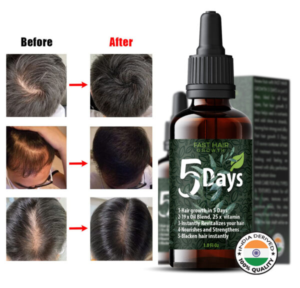 5 Days Fast Hair Growth Oil