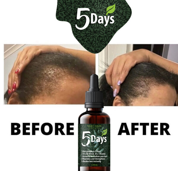 5 Days Fast Hair Growth Oil