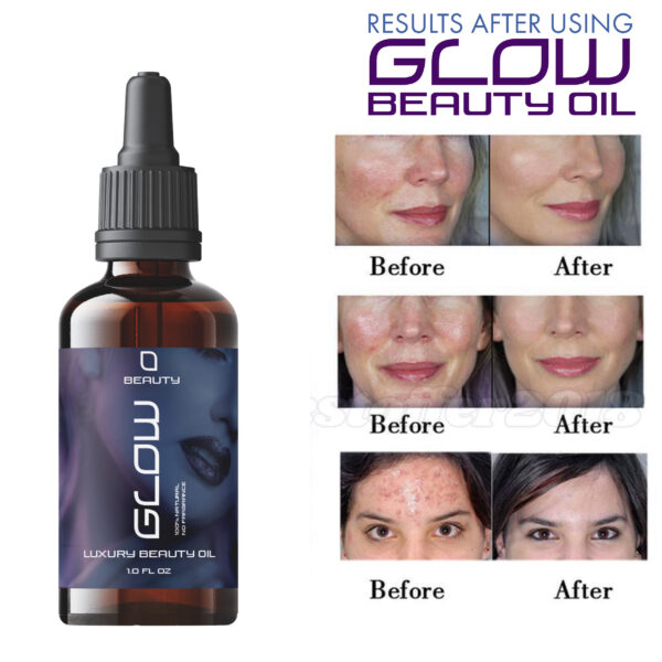 Glow beauty oil | Skin Solutionnnn