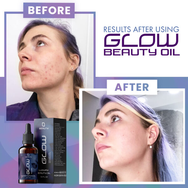 Glow beauty oil | Glow Skinnnnnn